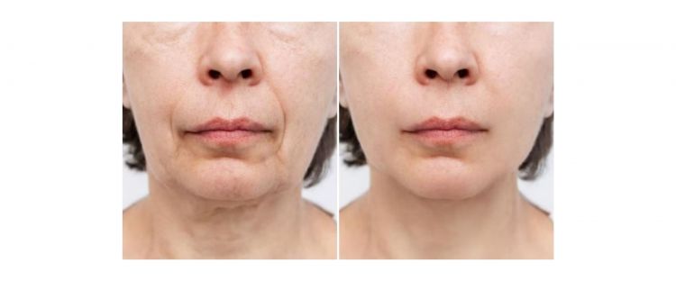 Trik kencangkan wajah kendur agar kembali muda dengan 1 jenis daun, tak butuh putih telur