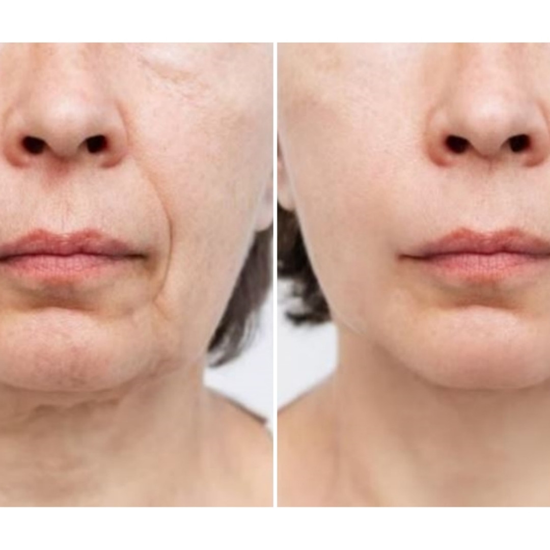 Trik kencangkan wajah kendur agar kembali muda dengan 1 jenis daun, tak butuh putih telur