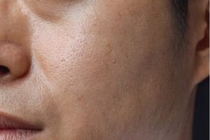 Cara bikin pori-pori mengecil cuma pakai 1 kulit buah, hasilnya kulit tampak mulus sempurna