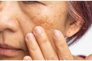 Trik kurangi kerutan dan noda hitam pada wajah, ampuh cuma pakai masker dari 1 bahan minuman