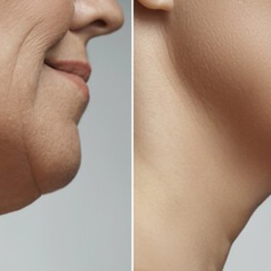 Cara menghilangkan kerutan di wajah mengendur, ampuh bikin kencang dengan 1 jenis sayuran