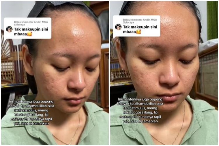 Transformasi cewek wajah bopeng usai dirias jadi pengantin bikin pangling, kulit gradakan auto mulus