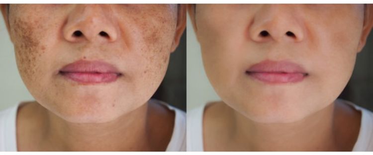 Trik memutihkan kulit kusam penuh daki pakai tanpa lulur wajah, ampuh bikin cerah pakai 1 jenis buah