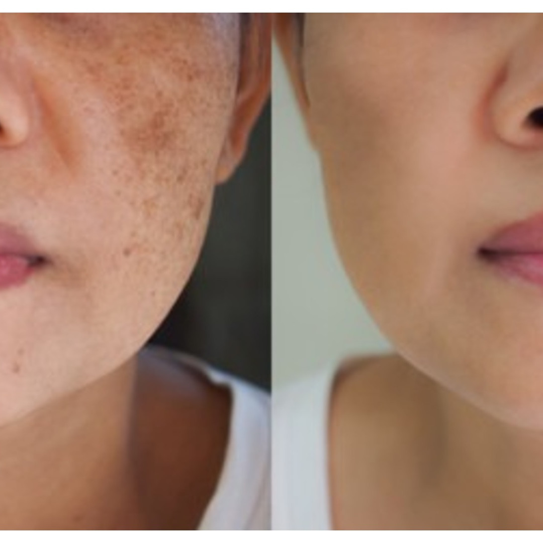 Trik memutihkan kulit kusam penuh daki pakai tanpa lulur wajah, ampuh bikin cerah pakai 1 jenis buah