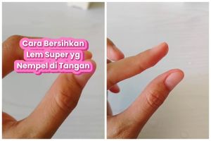 Bisa lepas lagi pakai 1 bahan dapur, ini trik aman bersihkan lem super yang menempel di jari tangan