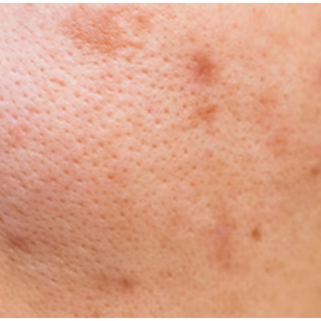 Cara bersihkan pori-pori wajah cuma andalkan 1 jenis tepung, ampuh bikin kulit terlihat mulus