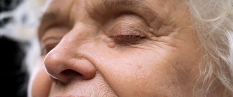 Cara atasi keriput tanpa pakai susu, ampuh wajah kembali kenyal cuma andalkan 1 bahan dapur