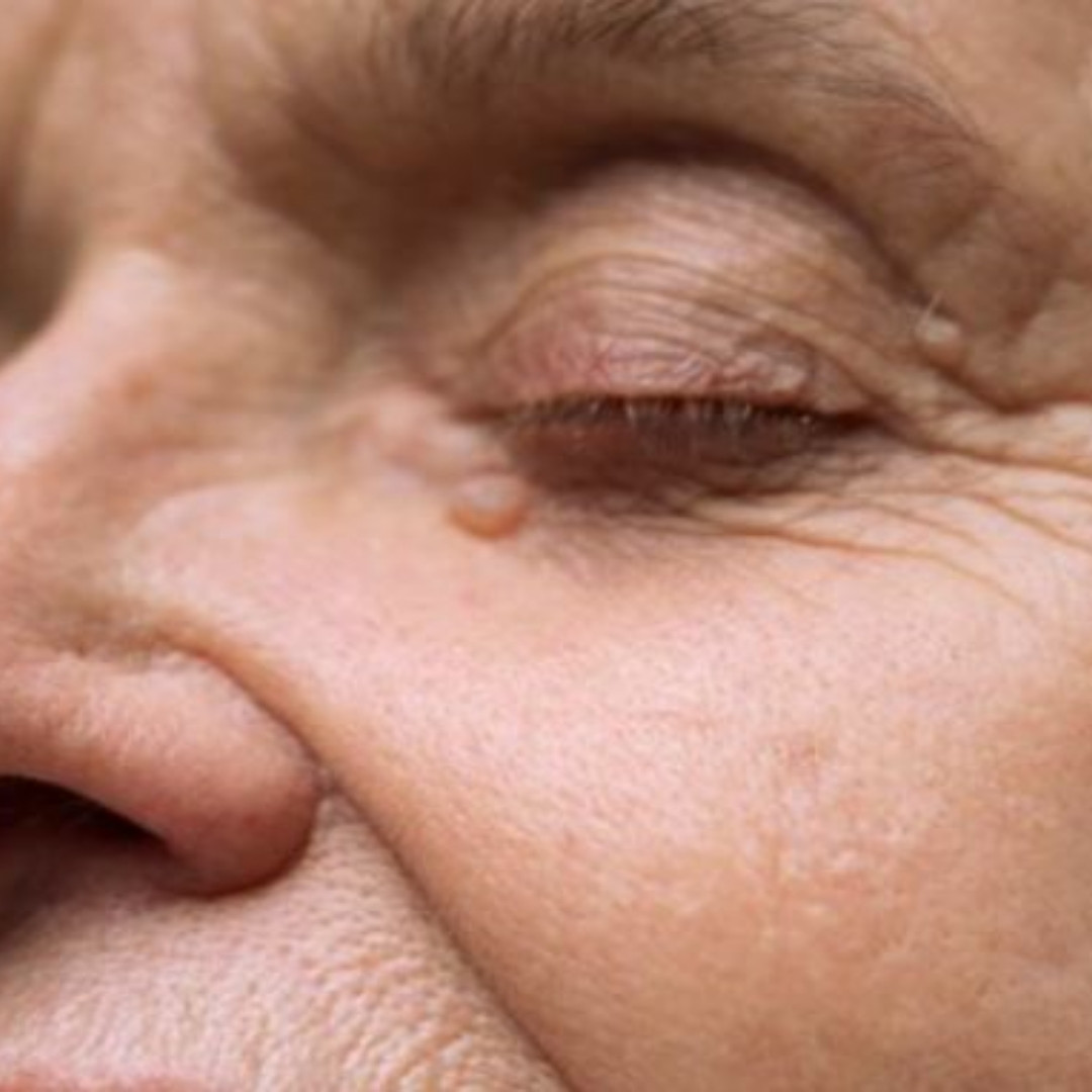 Cara atasi keriput tanpa pakai susu, ampuh wajah kembali kenyal cuma andalkan 1 bahan dapur