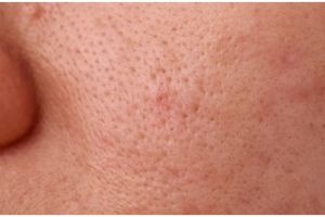 Cara bikin pori-pori wajah mengecil tanpa scrub kopi, ampuh tampak mulus pakai 1 kulit buah