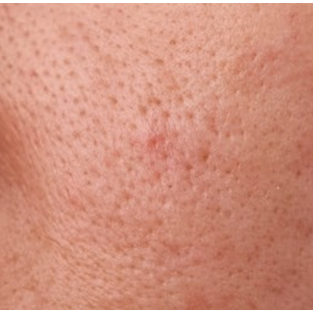 Cara bikin pori-pori wajah mengecil tanpa scrub kopi, auto tampak mulus pakai 1 kulit buah