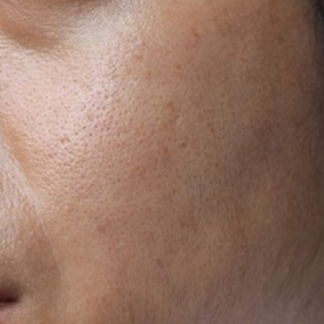 Trik bikin pori-pori mengecil, ampuh membuat kulit tampak mulus cuma andalkan 1 kulit buah