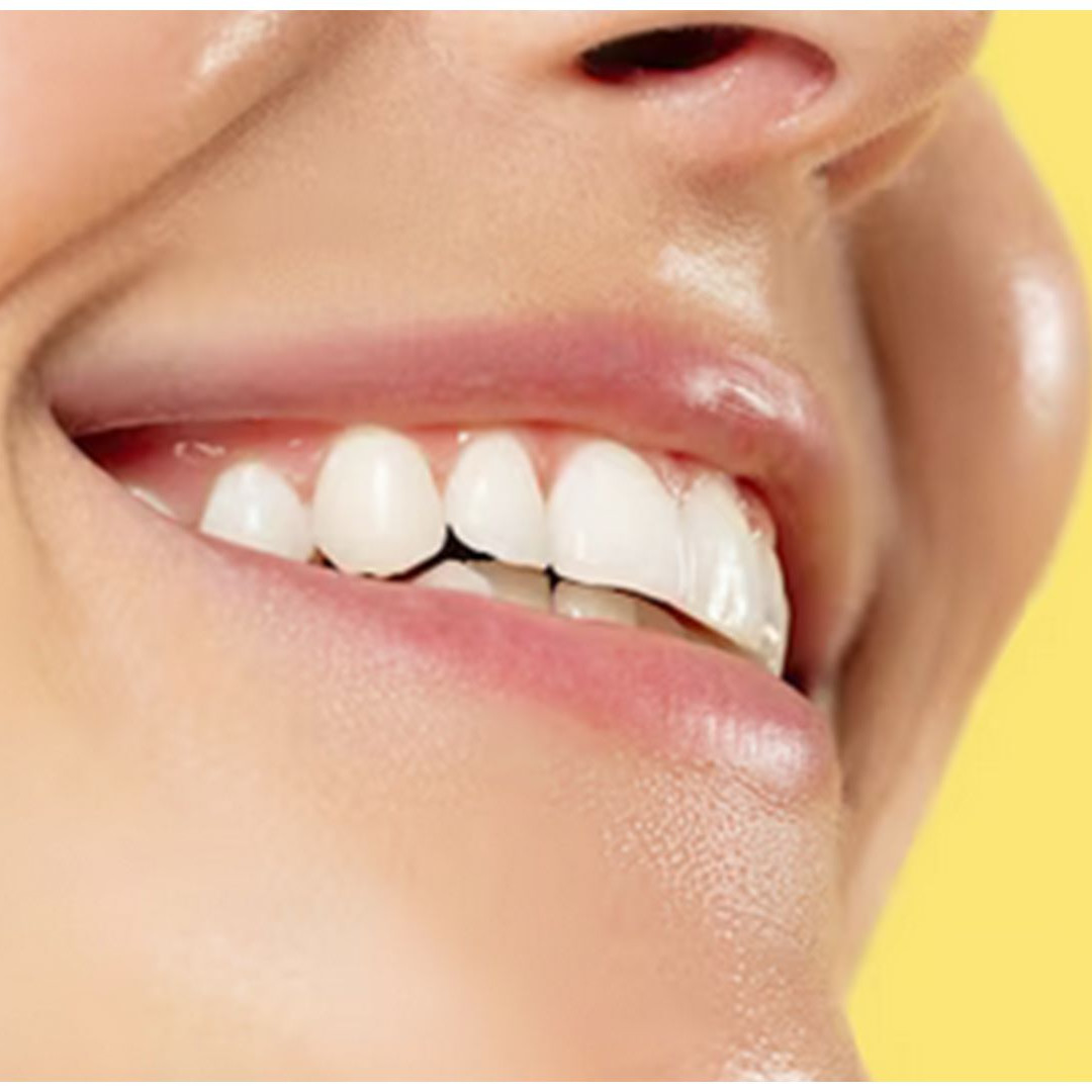 Trik rontokkan karang gigi dan atasi bau mulut tanpa perawatan ke dokter, cuma andalkan 1 sayuran