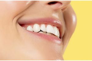 Trik rontokkan karang gigi dan atasi bau mulut tanpa perawatan ke dokter, ampuh andalkan 1 sayuran