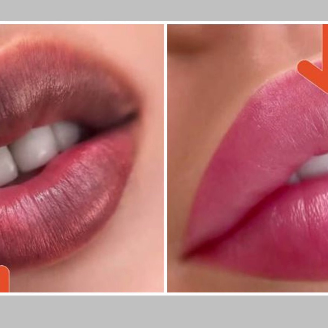 Cara atasi bibir menghitam jadi kembali merah alami tanpa sulam, cuma pakai 1 jenis umbi-umbian