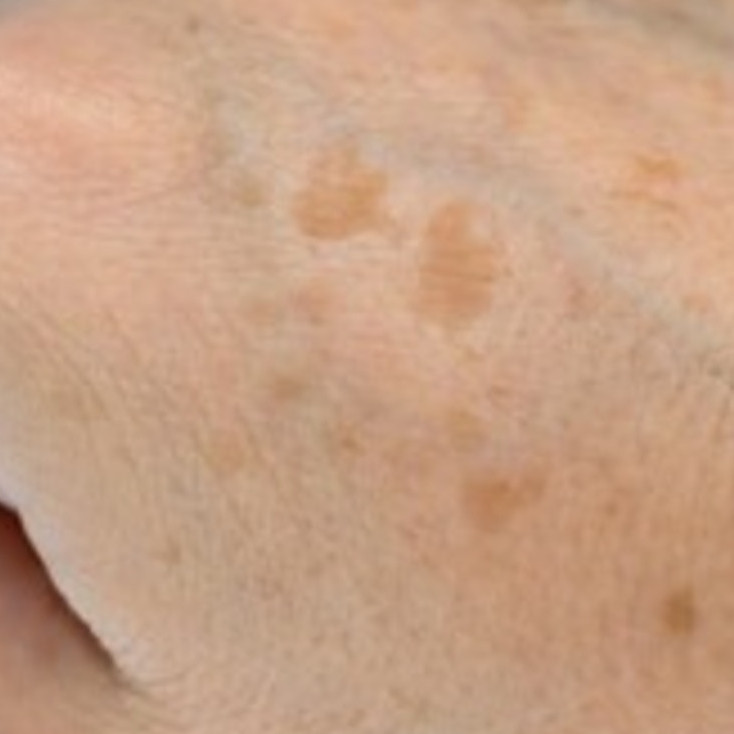 Cara ratakan warna kulit tangan tanpa perlu beli lulur, hilang belang pakai 1 bumbu dapur