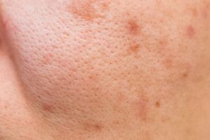 Cara bersihkan pori-pori wajah agar kulit terlihat mulus, cuma andalkan 1 jenis tepung