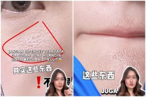 Jangan dipencet, ini trik hilangkan bintik-bintik kecil mirip komedo di wajah agar kulit kembali mulus