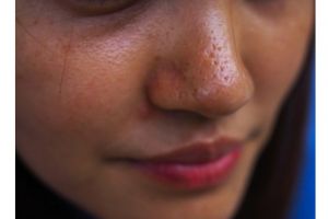 Trik bikin toner untuk kulit berminyak tanpa diusap es, rapatkan pori-pori andalkan 1 jenis sayuran