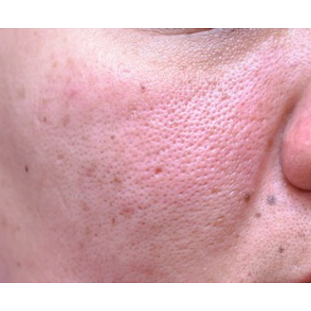 Cara kecilkan pori-pori tanpa beli porepack, ampuh bikin wajah bebas minyak pakai 1 bahan masak