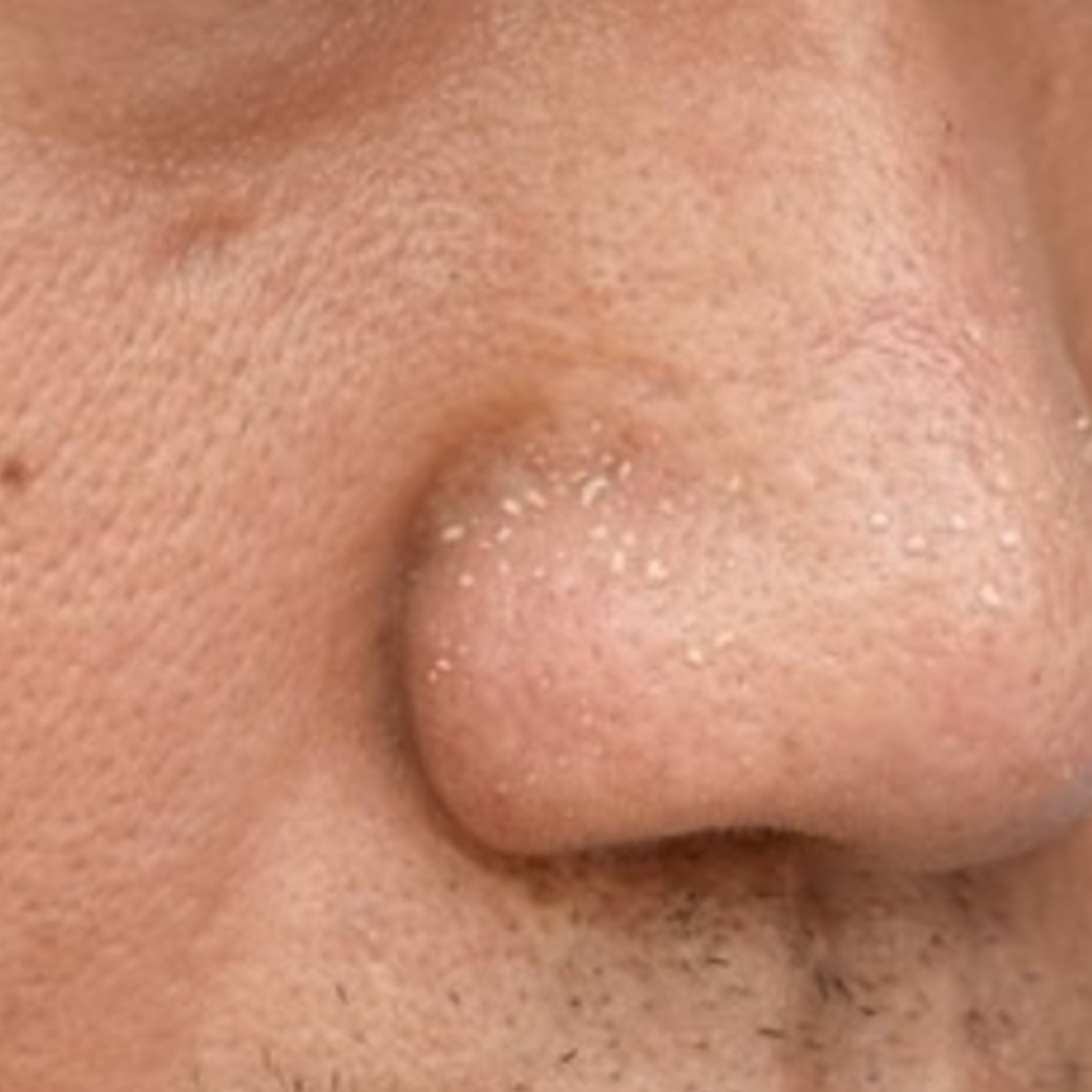 Trik ampuh bersihkan pori-pori wajah agar kembali rapat, cuma andalkan 1 jenis ampas minuman