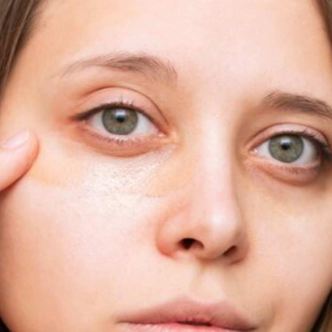 Dark circle dan kantung mata langsung hilang cuma andalkan 1 jenis bahan pemanis, ini cara membuatnya