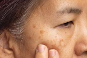 Trik pudarkan flek hitam akibat penggunaan kosmetik, ampuh cuma andalkan 3 bahan alami