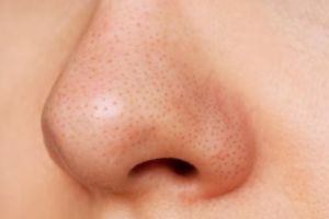 Cara kecilkan sekaligus bersihkan pori-pori, wajah mulus bebas komedo andalkan 1 jenis tepung