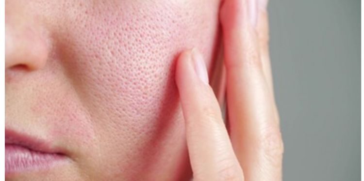 Trik bikin pori-pori besar jadi halus tersamarkan, cuma andalkan 1 jenis sumber protein