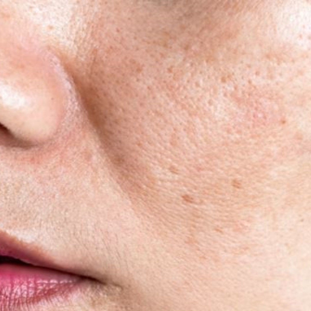 Trik ampuh cerahkan flek hitam dan wajah kusam ini cuma andalkan 1 jenis buah-buahan