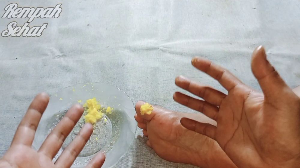 Cara alami menghilangkan mata ikan di telapak kaki ini ampuh cuma pakai 1 bahan dapur