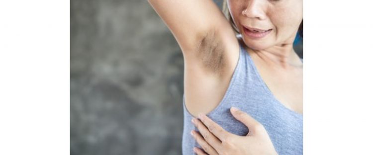 Cara singkirkan bau dan kulit gelap di ketiak pakai 1 jenis buah, ampuh nggak perlu beli deodoran lagi