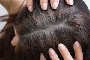 Hitam merata tanpa rambut putih, ini cara mengurangi tumbuhnya uban prematur pakai 1 jenis biji-bijian