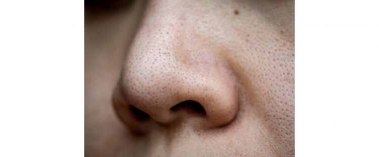 Bukan dengan madu, ini trik kecilkan pori-pori agar kulit kembali halus pakai 2 jenis minuman