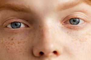 Bukan pakai rose water, ini rahasia mengatasi flek hitam di wajah dengan 1 rempah dapur