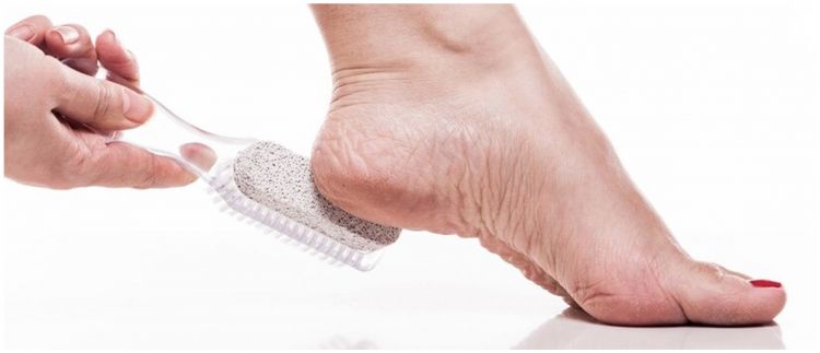 Jadi mulus dalam 10 menit, ini rahasia atasi tumit pecah-pecah dan hitam dengan 1 bahan herbal