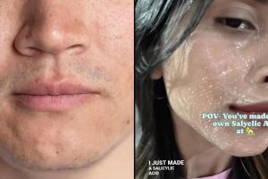 Tanpa eksfoliasi kimia, ini trik mengecilkan pori-pori agar wajah terlihat halus dengan 1 jenis buah