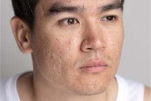 Bukan pakai aloe vera, ini cara efektif muluskan kulit kasar dan penuh daki dengan 1 jenis minuman