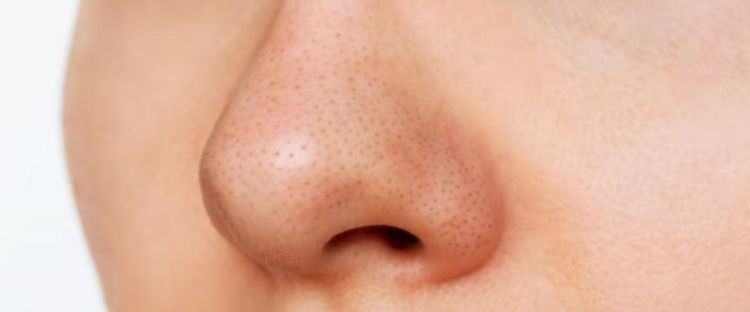 Cara kecilkan dan bersihkan pori-pori wajah pakai 1 jenis tepung, ampuh bikin wajah mulus bebas komedo