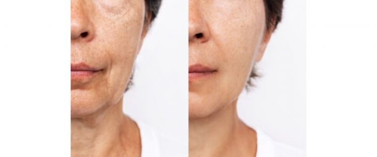 Bukan lidah buaya, 1 jenis biji-bijian ini ternyata bisa kurangi keriput, begini cara menggunakannya