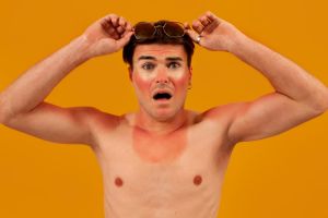 Tanpa skincare mahal, 1 jenis tanaman ini ampuh atasi wajah sunburn akibat paparan sinar matahari