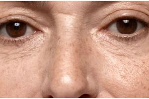 Tanpa laser, ini cara hilangkan flek hitam dan cerahkan wajah dengan 1 jenis buah