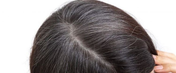 Nggak perlu disemir henna, ini cara mencegah uban tumbuh cepat hanya pakai 1 produk bayi