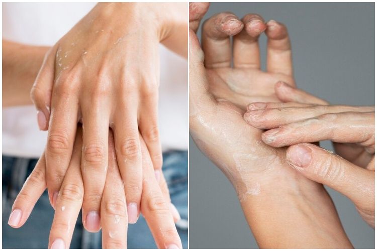 Tak perlu minyak zaitun, ini cara mudah dan simpel atasi tangan kasar dan keripit dengan 1 jenis buah