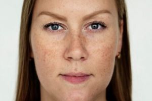 Bukan pakai madu, ini cara hempas flek hitam membandel di wajah pakai cuma pakai 1 jenis tepung