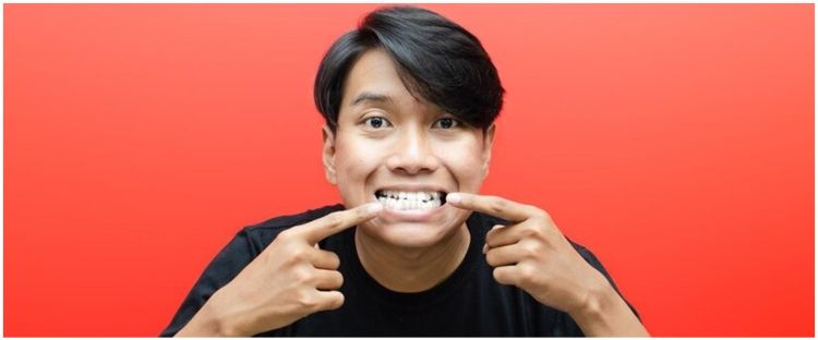 Noda kuning hilang seketika dan tak tersisa, ini cara rontokkan karang gigi hanya pakai 1 bahan alami