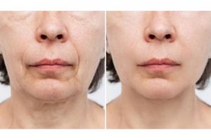 Trik sederhana kencangkan wajah kendur agar kembali muda dengan 1 jenis daun penyedap