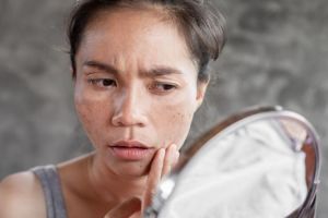 Campuran bubuk kunyit dan 2 bahan alami efektif pudarkan dark spot di wajah, tanpa tambahan kopi