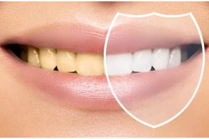 Bukan kumur pakai minyak kelapa, begini cara hilangkan noda kuning di gigi gunakan 1 bahan dapur