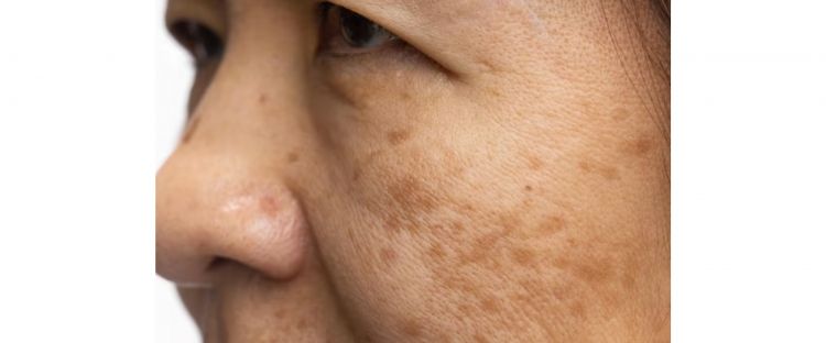 Trik ratakan warna kulit wajah dan samarkan keriput ini bantu wajah kembali berseri, auto tampak muda