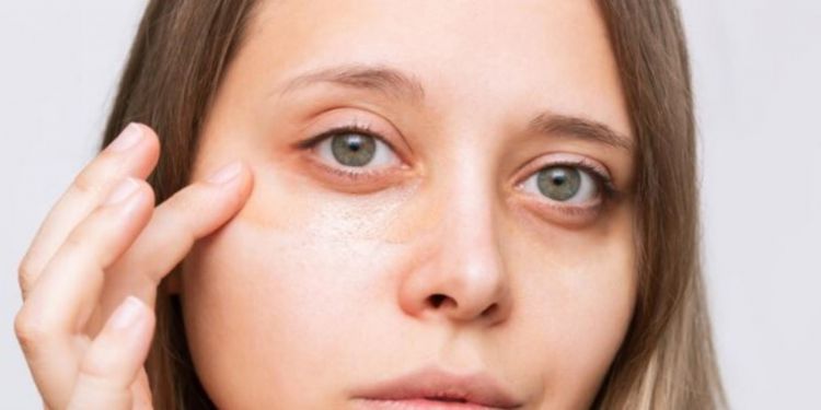 Cuma pakai 3 jenis minyak, begini cara hilangkan kantung mata tanpa masker kopi